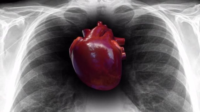X射线内部的人的心跳。心脏泵血。