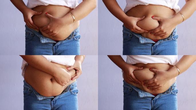 腹部肥胖-女人