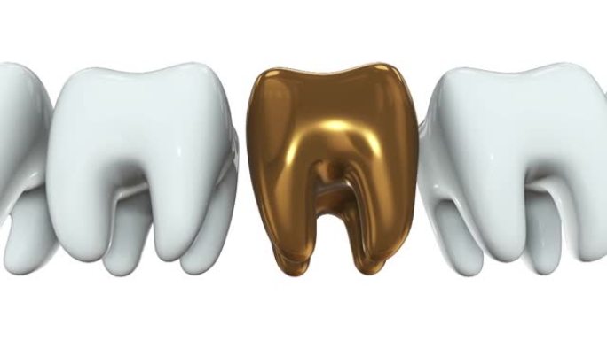 一排白色牙齿3D中的金色牙齿