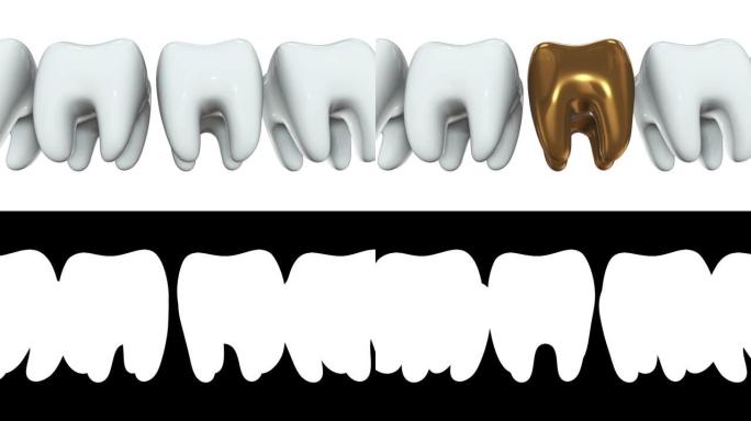 一排白色牙齿3D中的金色牙齿