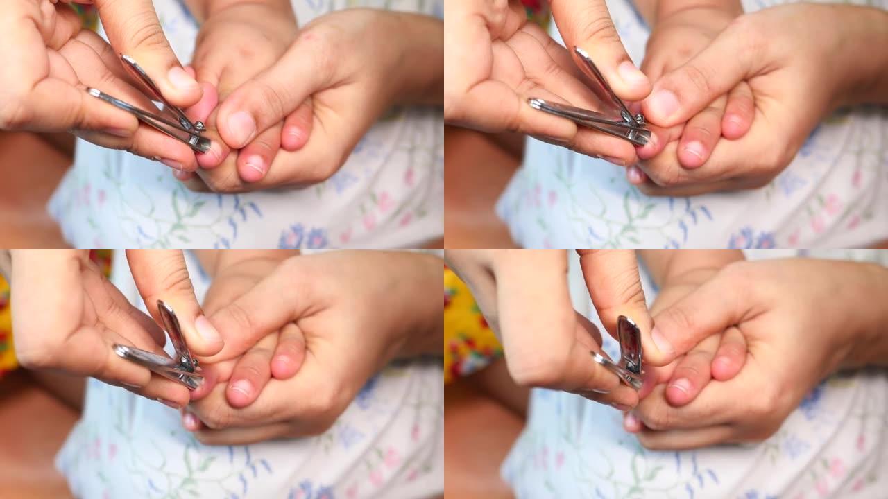 儿童指甲剪得很近。