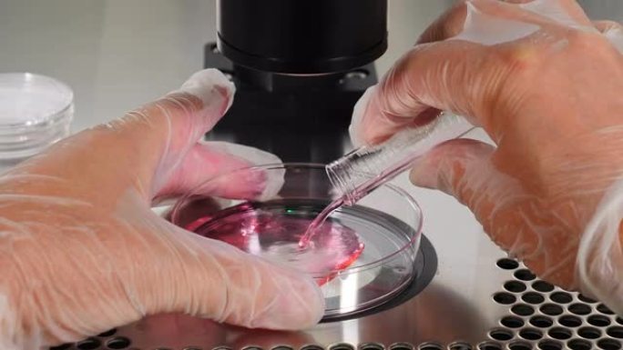 试管婴儿手术的特写镜头。胚胎学家在保护手套中从培养皿中的塑料试管中滴下培养基，用剥蚀移液针收集卵。生