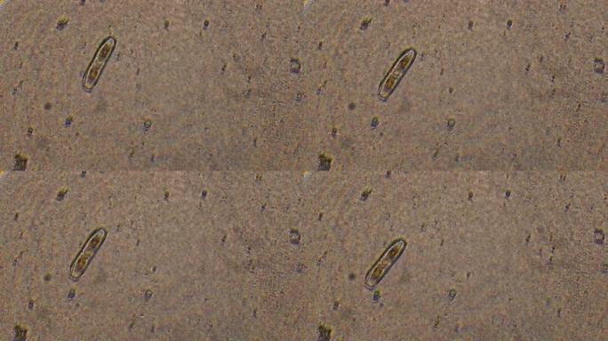 硅藻的显微镜检查。单细胞生物的放大倍数为300倍。玻璃和pennales制成的细胞壁往往会拉长。