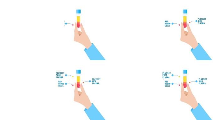 医生手中管的PRP血液结构信息图表动画模板