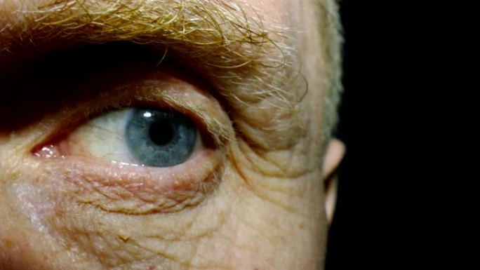 一只有着红色毛细血管的老人的眼睛。