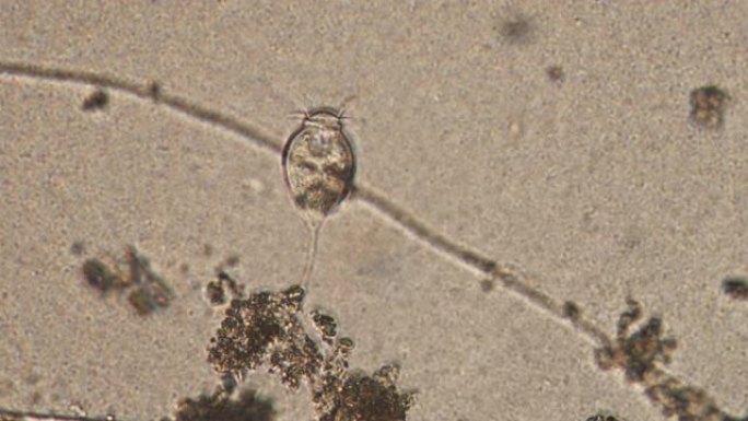 水 (池塘) 样品中原生动物的显微镜。Infusoria附着在基质上，用细菌吸水。身体前部纤毛的放大
