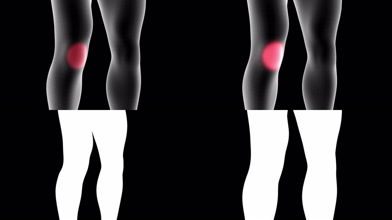 男性x射线全息图的3d动画显示了带有alpha通道的腿部膝盖前部区域的疼痛区域