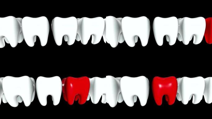 一排白色牙齿中的红牙。3D渲染。牙科，出众，经营理念。