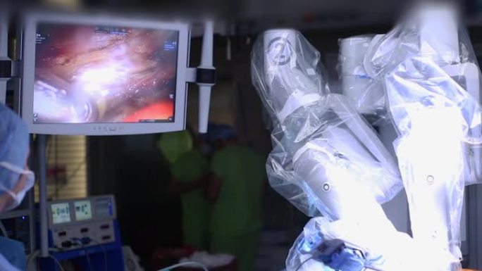 达芬奇手术系统的微创机器人手术。机器人手术。涉及机器人的医疗操作。