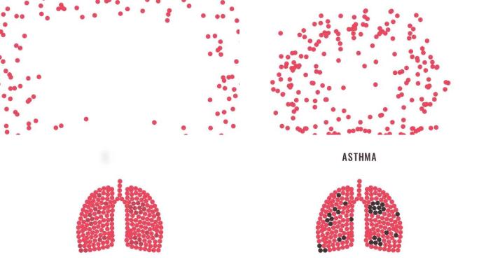 哮喘意识丸动画