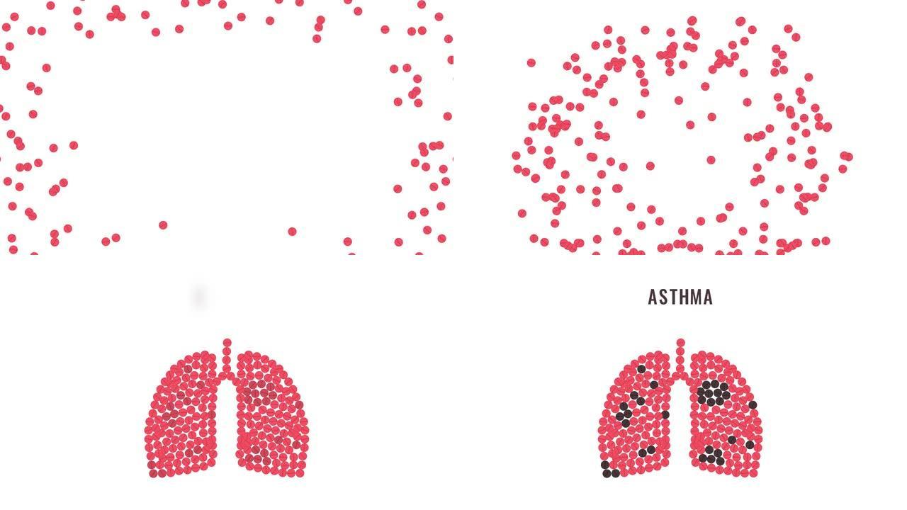 哮喘意识丸动画