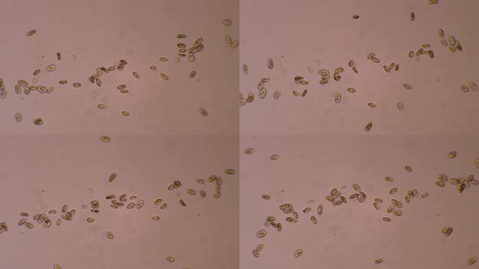 漂浮在水中的纤毛虫微生物的菌落