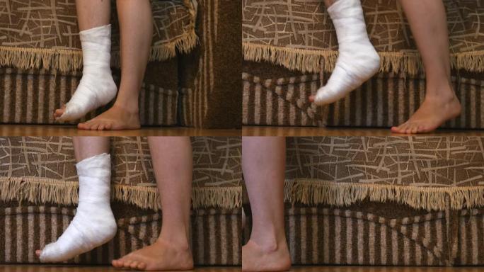 女孩骑在一条腿上，女人的腿在石膏上投射脚趾移动。腿部骨折。