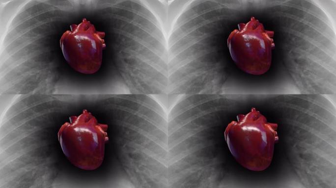 人体心脏在x光骨骼内跳动。抽血。