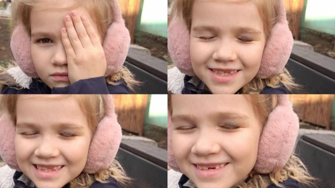 一个小女孩用手遮住左眼的淤青。眼睑瘀伤。