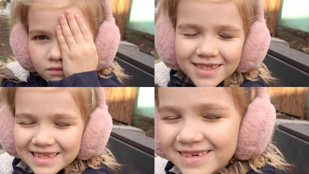 一个小女孩用手遮住左眼的淤青。眼睑瘀伤。