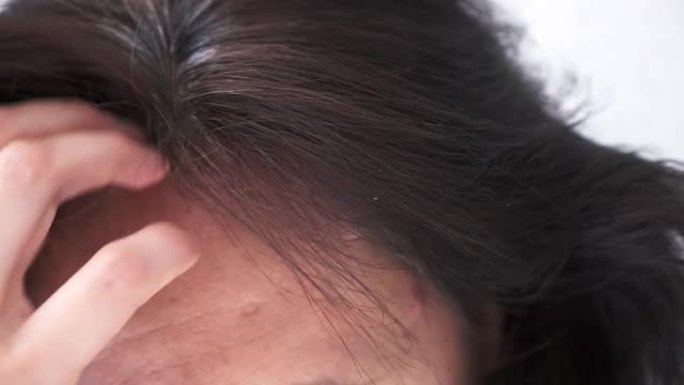一位中年妇女用灰白的发根抚摸着她的黑发