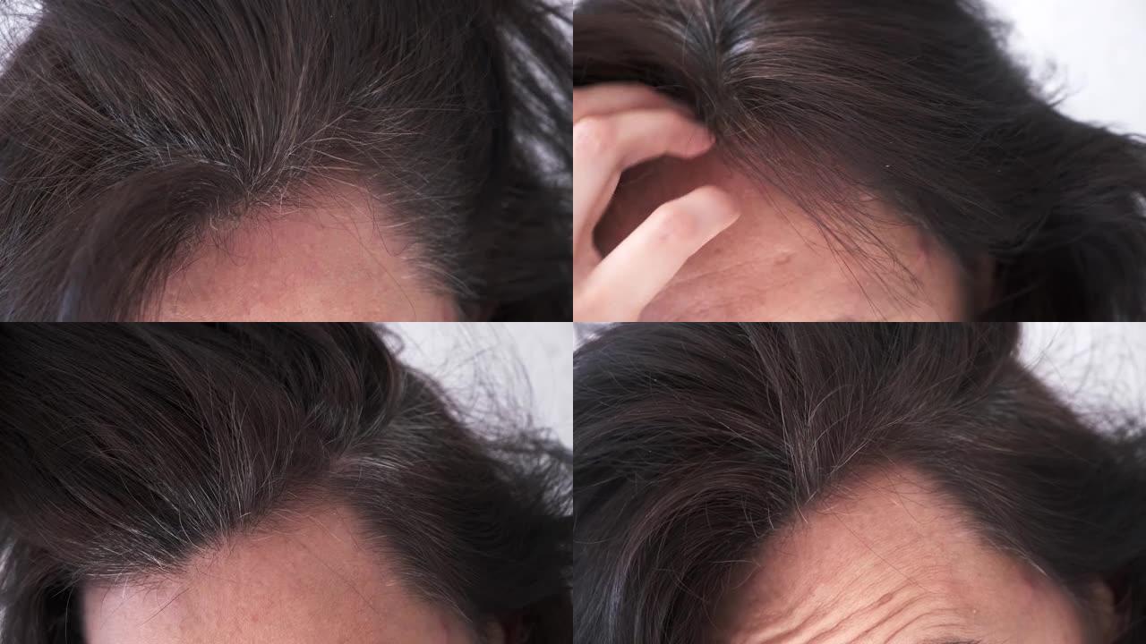 一位中年妇女用灰白的发根抚摸着她的黑发