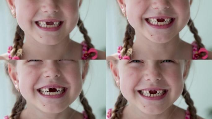 一个女孩的特写微笑。一个6-7岁的漂亮小女孩掉了乳牙。乳牙脱落，恒牙更换。儿童是牙科。