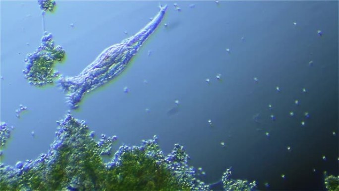 微生物-轮虫，暗视野显微镜