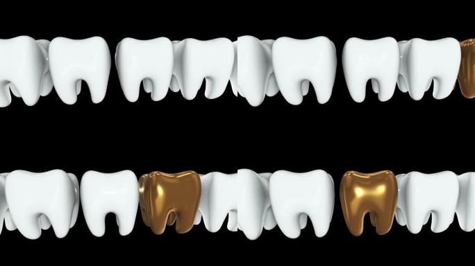 一排白色牙齿中的金色牙齿。3D渲染。牙科，出众，经营理念