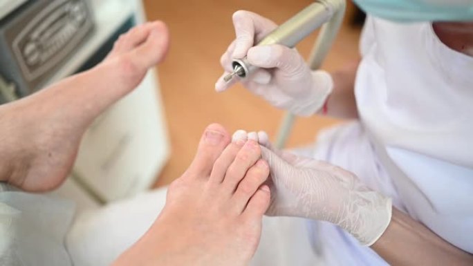 五金医用修脚，带指甲锉钻具。儿科医生修脚治疗的患者。水疗中心用特殊装置进行足部脱皮治疗。足病科的临床