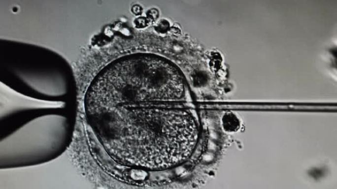 卵胞浆内单精子注射。体外受精的显微镜观察。进行精子注射的胚胎学家，ivf icsi。4 k视频