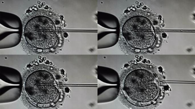 卵胞浆内单精子注射。体外受精的显微镜观察。进行精子注射的胚胎学家，ivf icsi。4 k视频