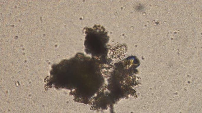 水样中纤毛 (Cothurnia sp。) 的显微镜检查。Infusoria附着在基质上，用细菌吸水