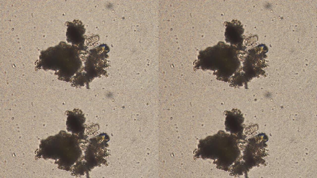 水样中纤毛 (Cothurnia sp。) 的显微镜检查。Infusoria附着在基质上，用细菌吸水