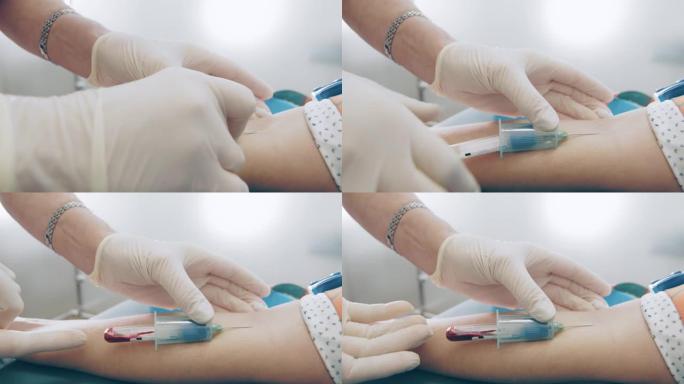 护士用针刺穿手特写。实验室工作人员采集血液样本以获取针对病毒的抗体。实验室采血
