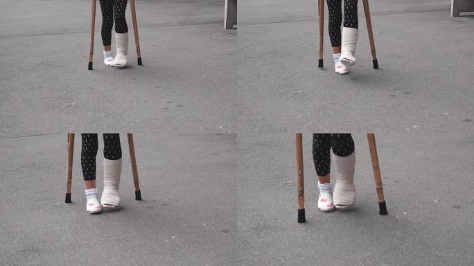 脚踝骨折的孩子在街上拄着拐杖和石膏走路。投在孩子们的脚上。在户外散步。事故，脚踝骨折。选择性聚焦。