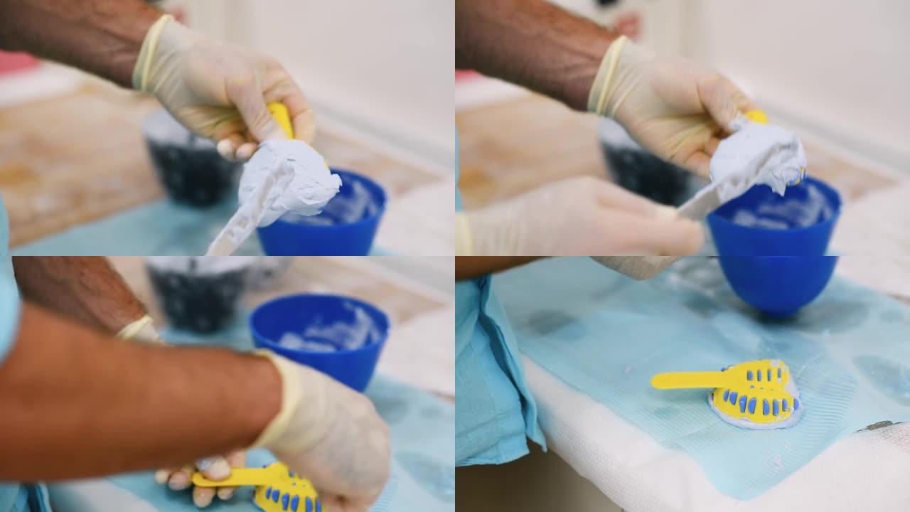 医生在正畸诊所用石膏制作了一个人的下巴模型。对准器的控制和诊断强制转换。