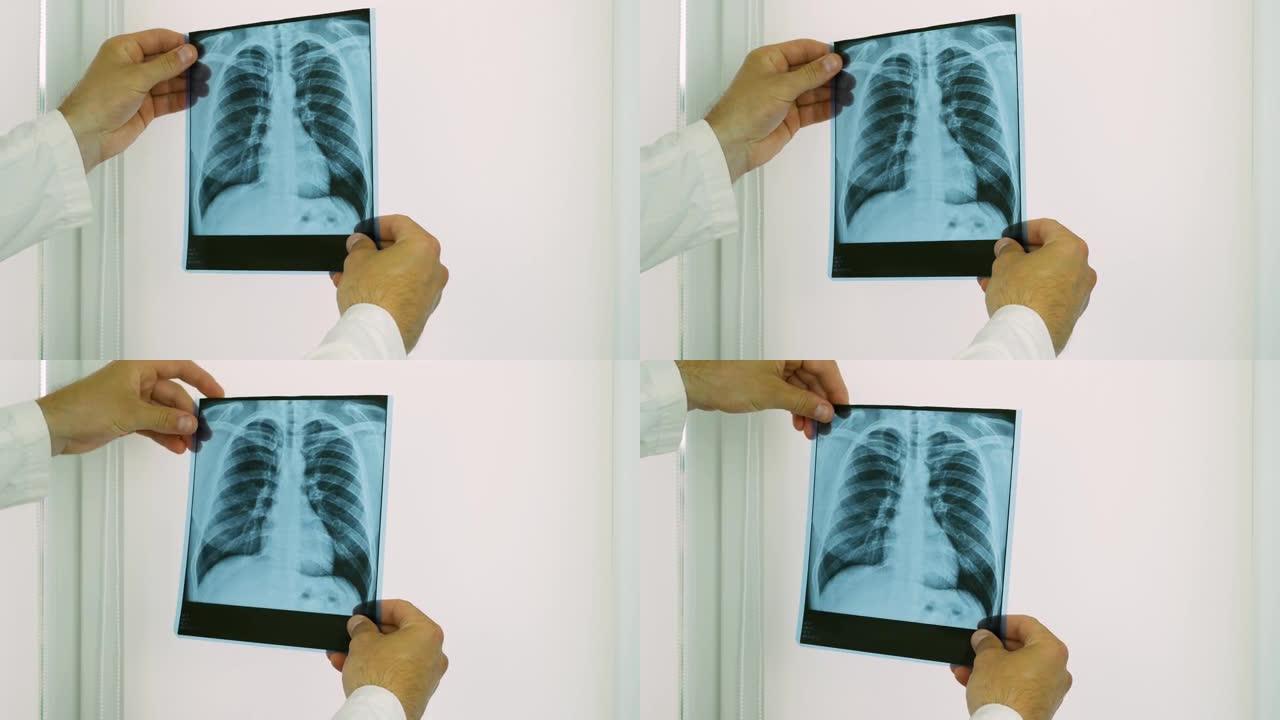 办公室里的医生看一个人肺部的x光，做出诊断，检查肺部的照片，诊断水肿，医务人员仔细看肺部。