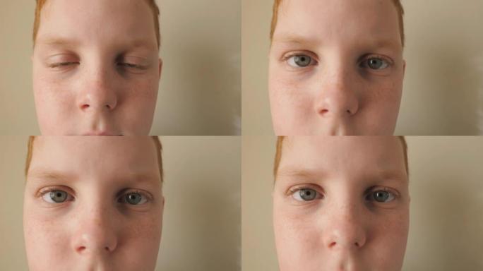 红发小男孩的蓝眼睛眨眨眼，看着疲惫的镜头。用雀斑关闭小姜孩子的悲伤凝视。绝望的男孩子的面部表情。