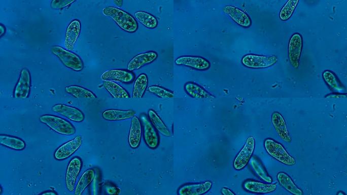 漂浮在水中的纤毛虫微生物的菌落