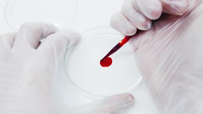 医生的手在保护手套在培养皿中做血液检查的特写镜头。
