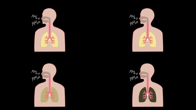 一段视频显示了细小灰尘进入肺部的过程。