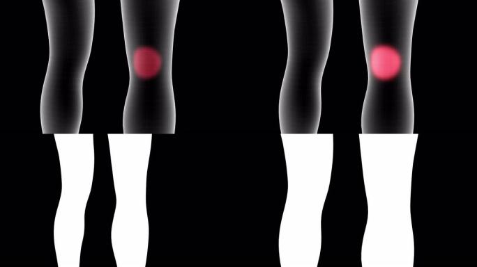 女性x射线全息图的3d动画显示了带有alpha通道的腿部膝盖背部区域的疼痛区域