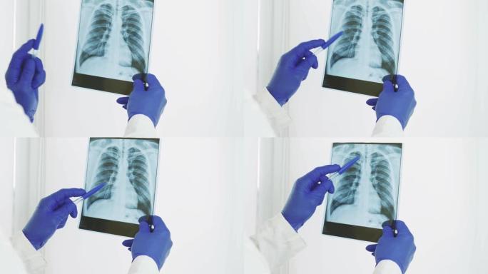 一名医务工作者，一名医生手里拿着x光，做出诊断、医学意见、肺炎和肺水肿