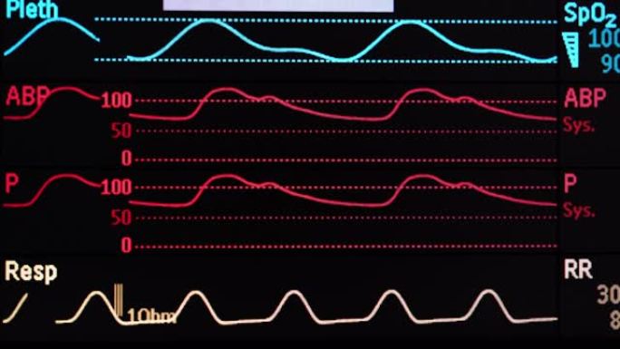 生命体征监测屏幕医疗监测