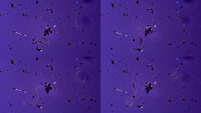线虫，显微放大假体腔动物病原体蛔虫鞭虫
