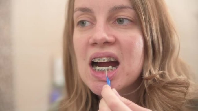 女人用牙刷清洁牙套。牙套护理