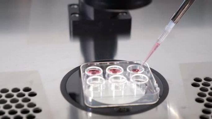 细丝实验室操作的特写，将胚胎从冷冻保护剂转移到特殊的医疗工具以进行后续冷冻。专家用移液管取胚胎。4 