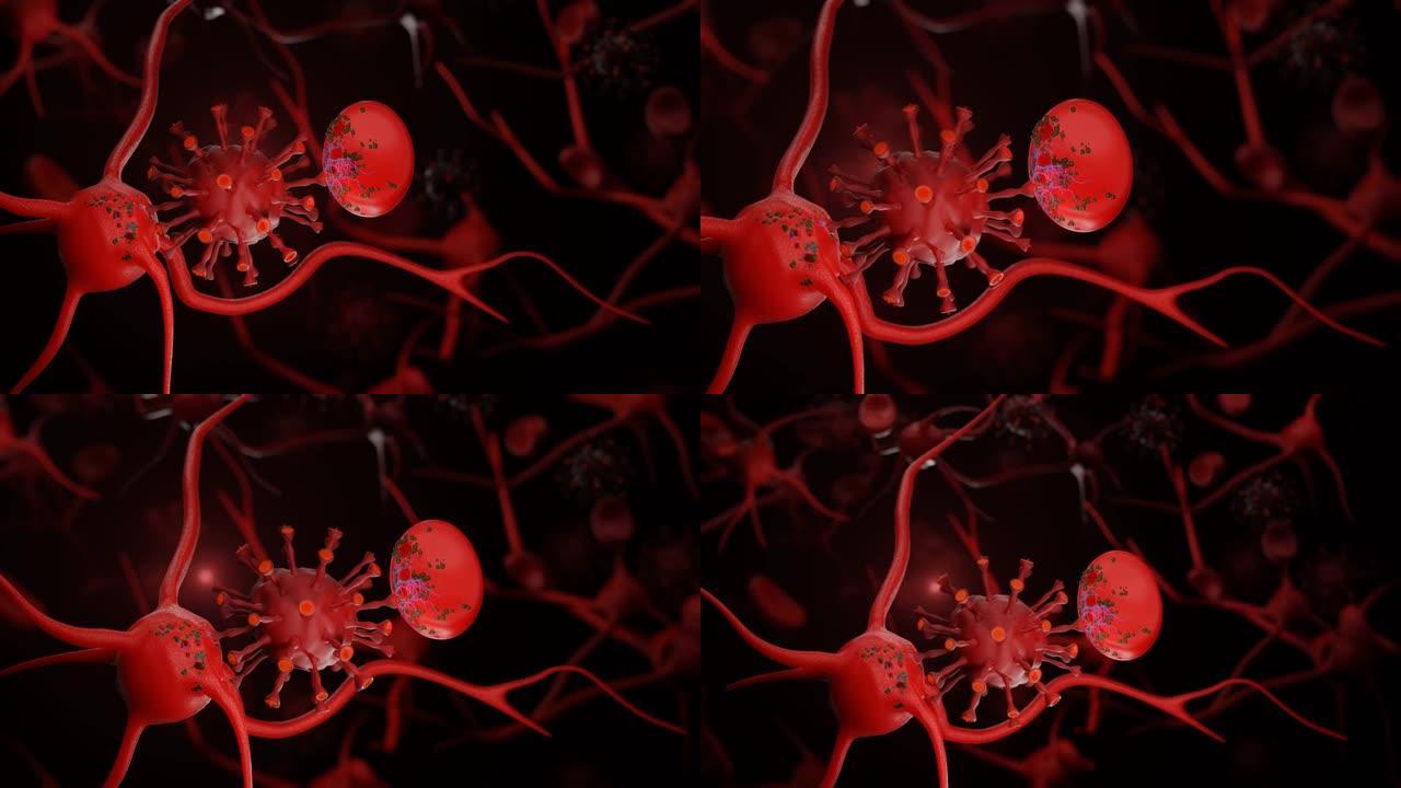 冠状病毒疾病新型冠状病毒肺炎感染医学概念。病毒细胞攻击血细胞和神经元。