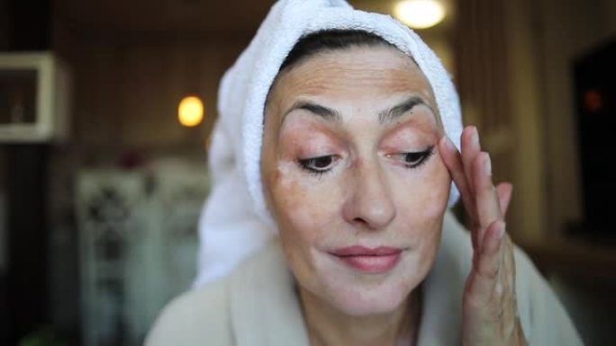 皮肤上有白癜风的女人涂面霜-女人在脸上涂面霜的肖像-早晨的例行程序，在脸上涂日霜