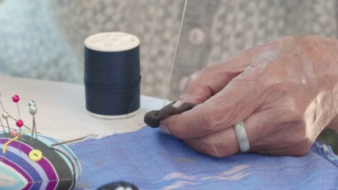 老年妇女针刺工艺品职业疗法治疗阿尔茨海默病