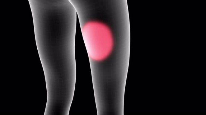 女性x射线全息图的3d动画显示了带有alpha通道的腿部大腿背部区域的疼痛区域