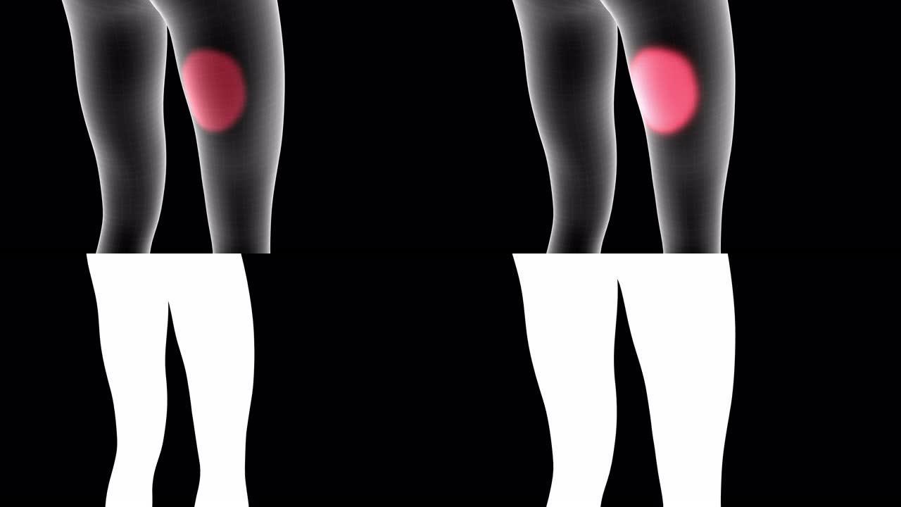 女性x射线全息图的3d动画显示了带有alpha通道的腿部大腿背部区域的疼痛区域