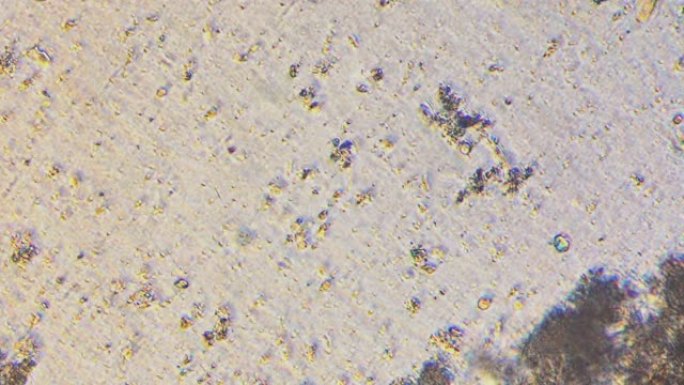 水样中原生动物和细菌的多个菌落的显微镜检查。放大300x细胞在主动运动。